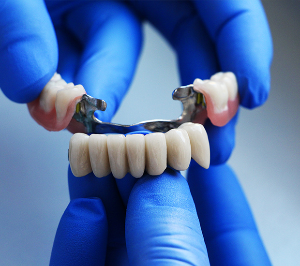 Rosenberg Dental Bridges