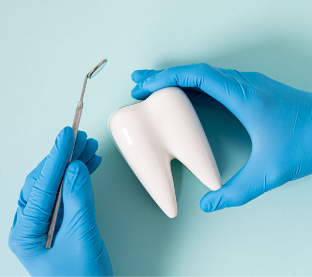 Rosenberg Tooth Extraction